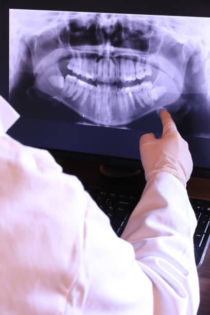 Best Emergency Gum Treatment in Lakeview, OH
