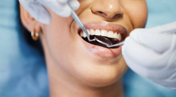 Best Same-Day Emergency Dental Services in Lakeview, OH